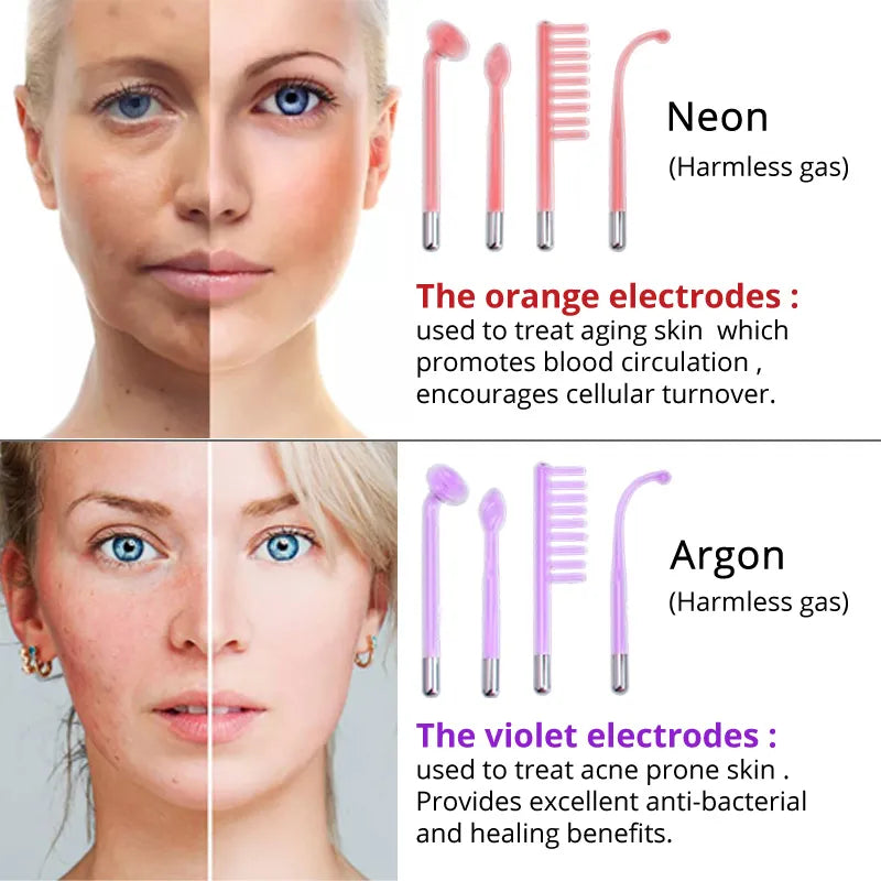 High Frequency Facial Device (Argon Gas) for Acne/Antibacterial
