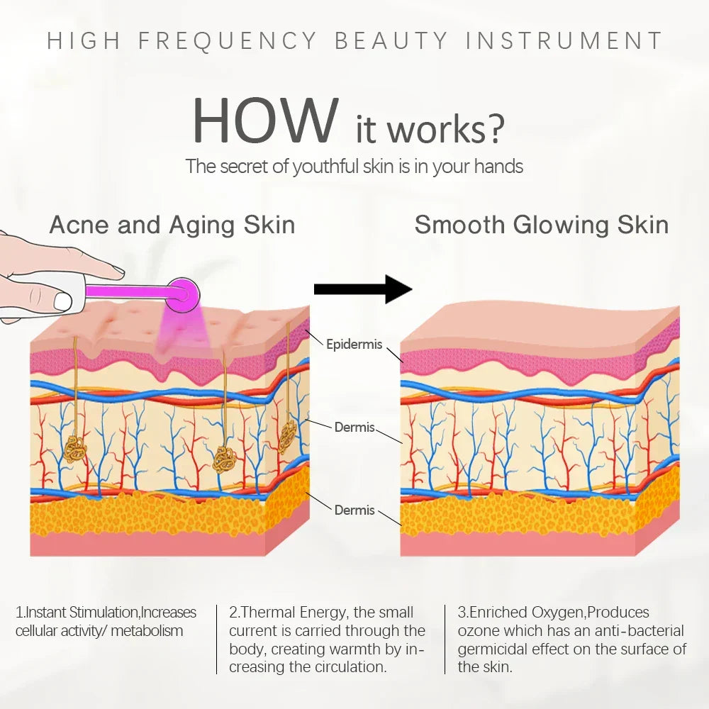 High Frequency Facial Device (Neon Gas) Antiaging